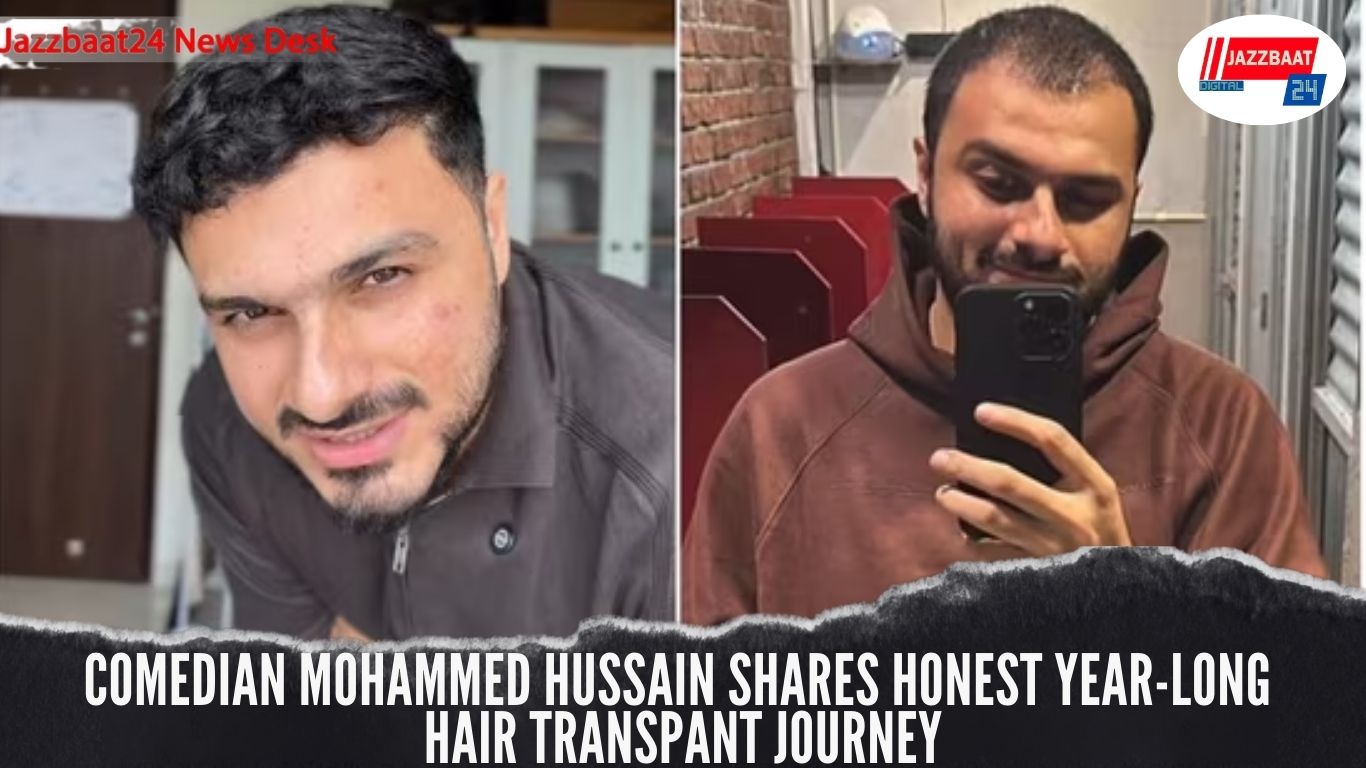 Comedian Mohammed Hussain Shares Honest Year-Long Hair Transplant Journey
