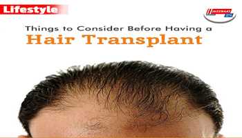 Know these important things before getting a hair transplant