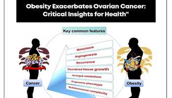 OBESITY EXACERBATES OVARIAN CANCER: "CRITICAL INSIGHTS FOR HEALTH"...


