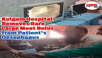 First-Ever Large Meat Bolus Successfully Removed from Patient’s Oesophagus at District Hospital Kulgam