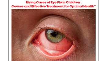 RISING CASES OF EYE FLU IN CHILDREN: CAUSES AND EFFECTIVE TREATMENT FOR OPTIMAL HEALTH
