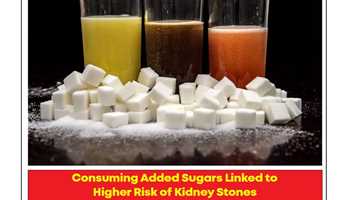 CONSUMING ADDED SUGARS LINKED TO HIGHER RISK OF KIDNEY STONES