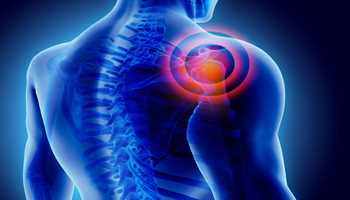 Simple Home Remedies to Relieve Shoulder and Neck Pain