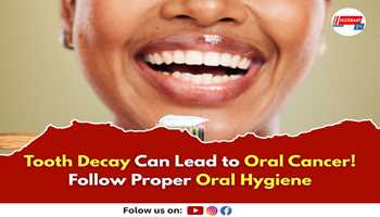 Tooth Decay Can Lead to Oral Cancer! Follow Proper Oral Hygiene