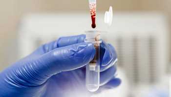 HUMANS RECEIVE LAB-GROWN BLOOD IN WORLD'S FIRST TRIAL TO COMBAT RARE DISORDERS 