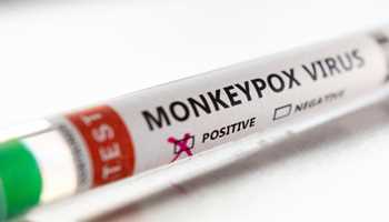 Monkeypox outbreak: Israel, Austria, Switzerland also report Monkeypox cases